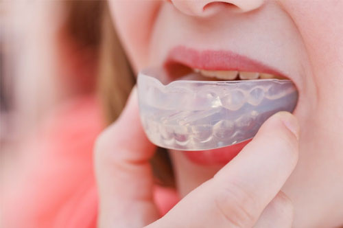 3 Different Ways A Custom Mouthguard Can Help You